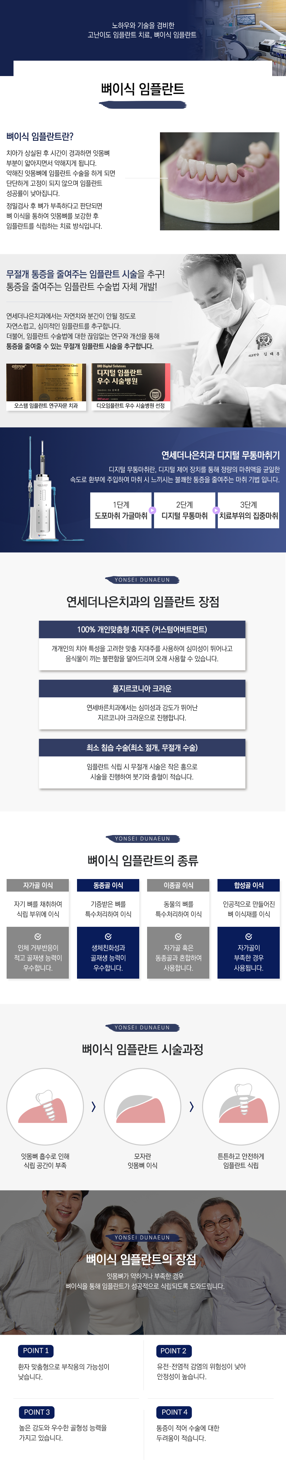 뼈이식 임플란트